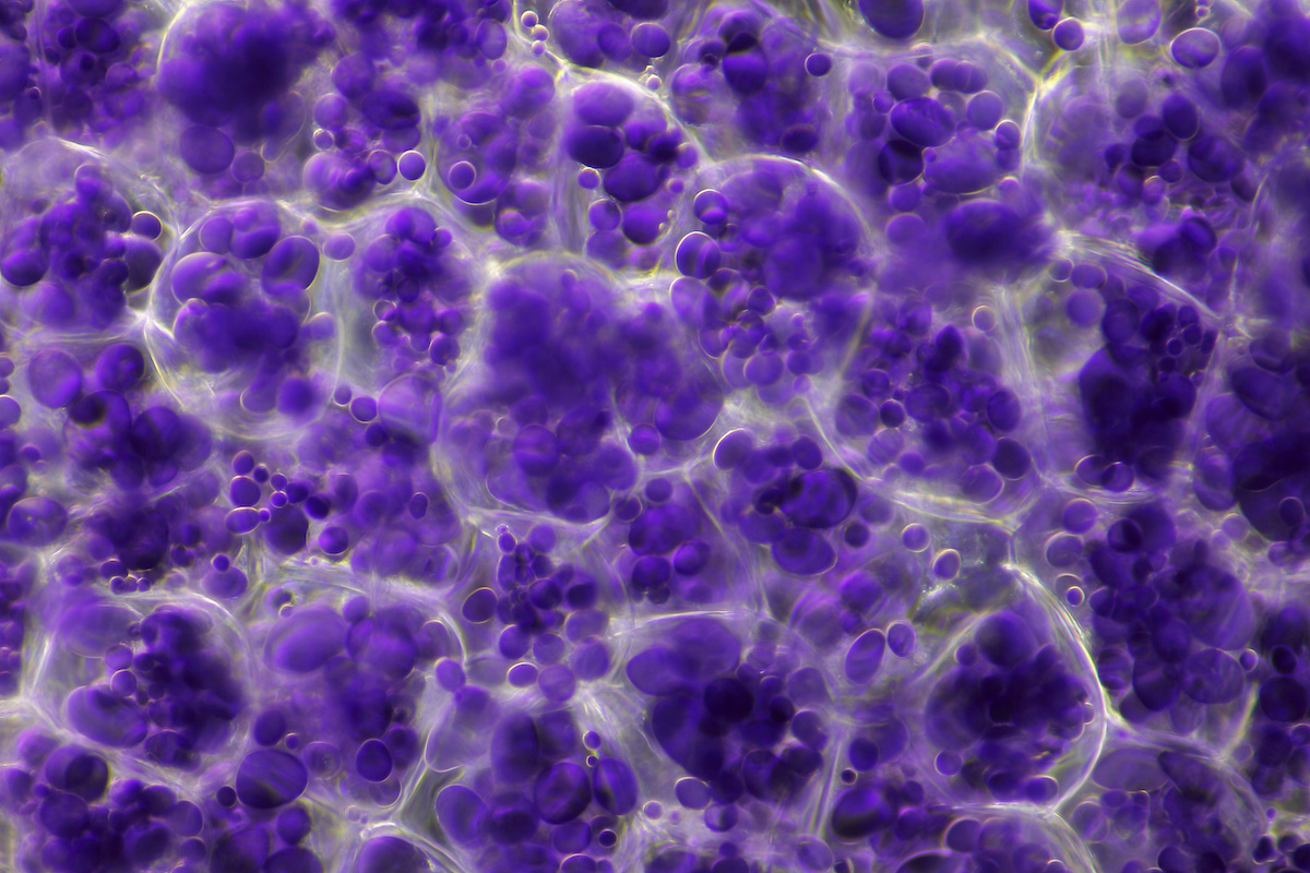 granuli-di-amido-di-patata-visti-al-microscopio-by-pawel-burgiel-adobe-stock-1200x800.jpeg